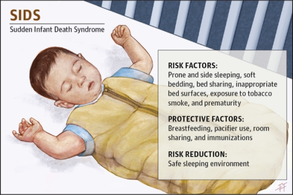 SIDS vaccination